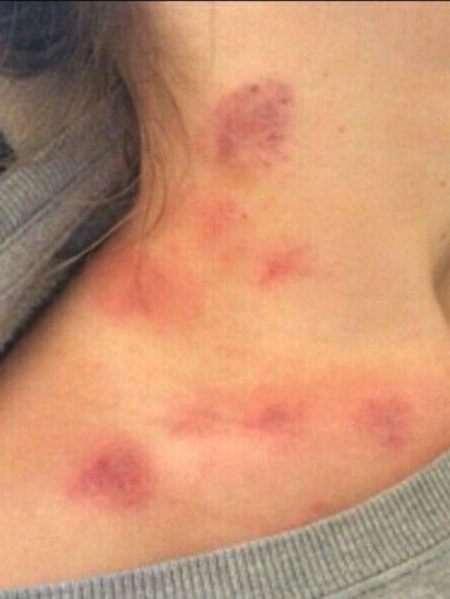 68+ Love Bites Images for Passionate Moments