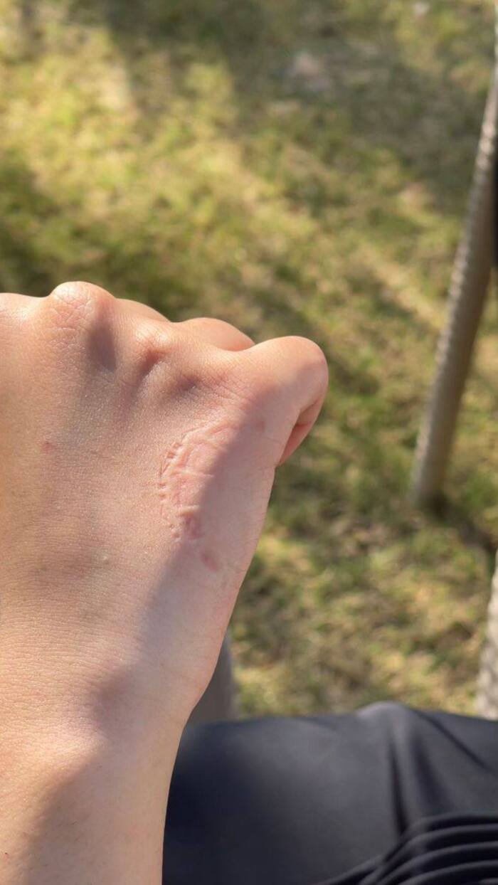 full size love bites images