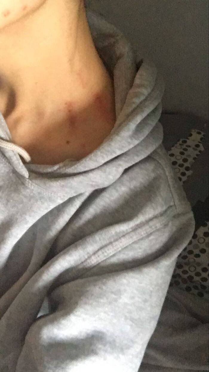hd love bites images