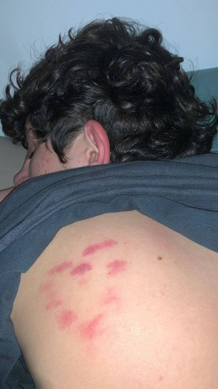 love bites images full hd