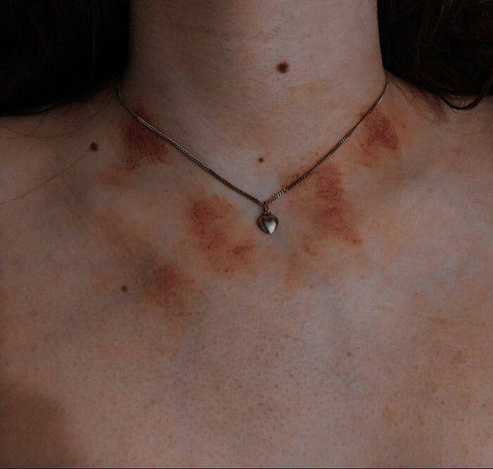 love bites images full size ins