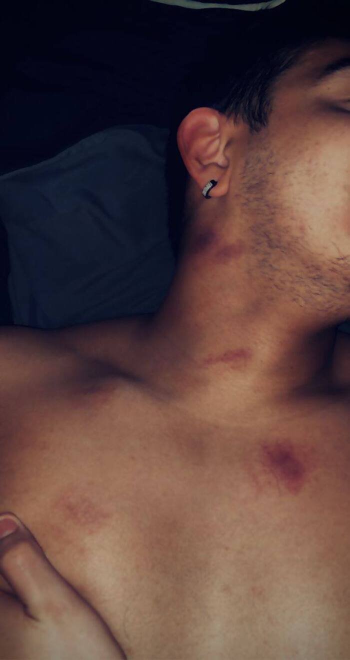 love bites images full size pinterest