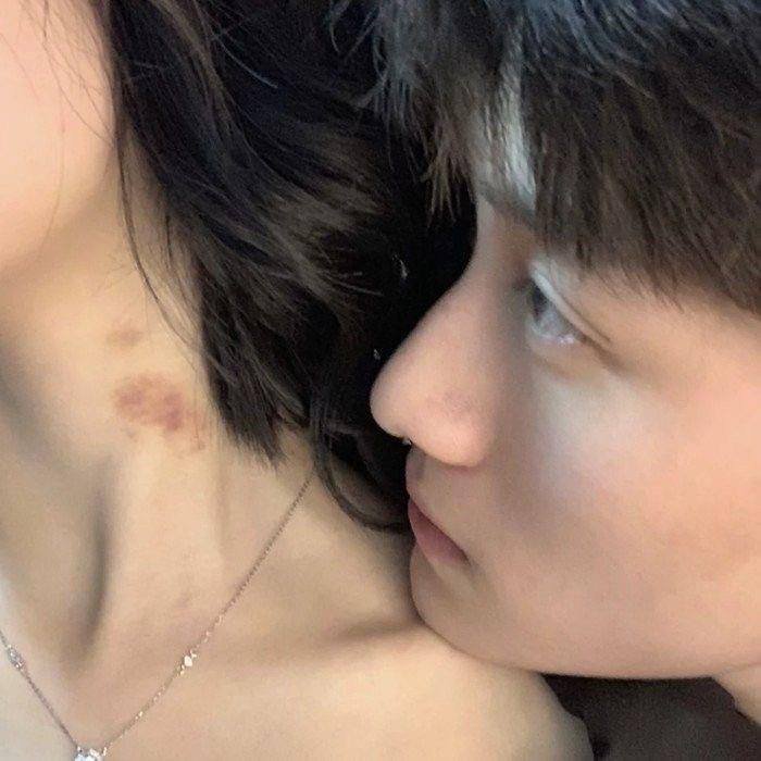 love bites images hd ig