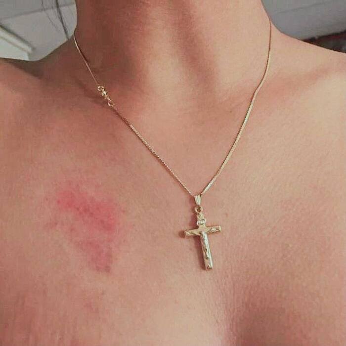 love bites images photo pinterest