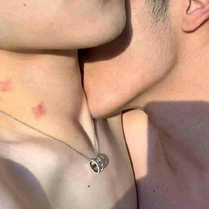 love bites images pinterest hd