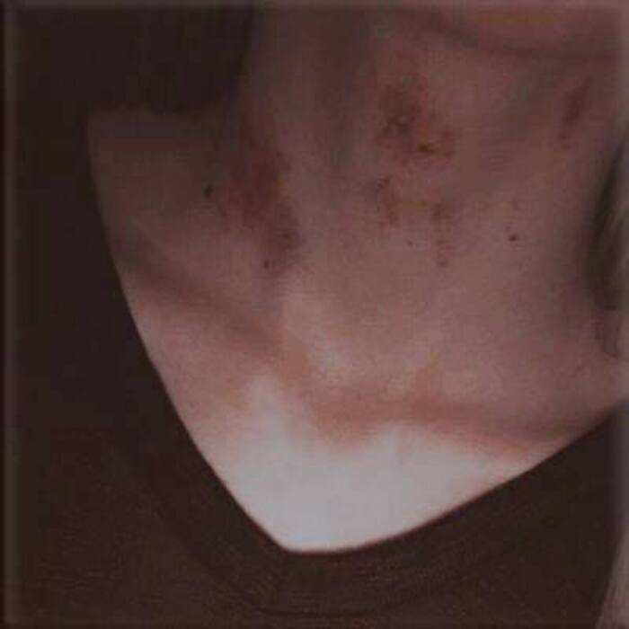 love bites images pinterest ig
