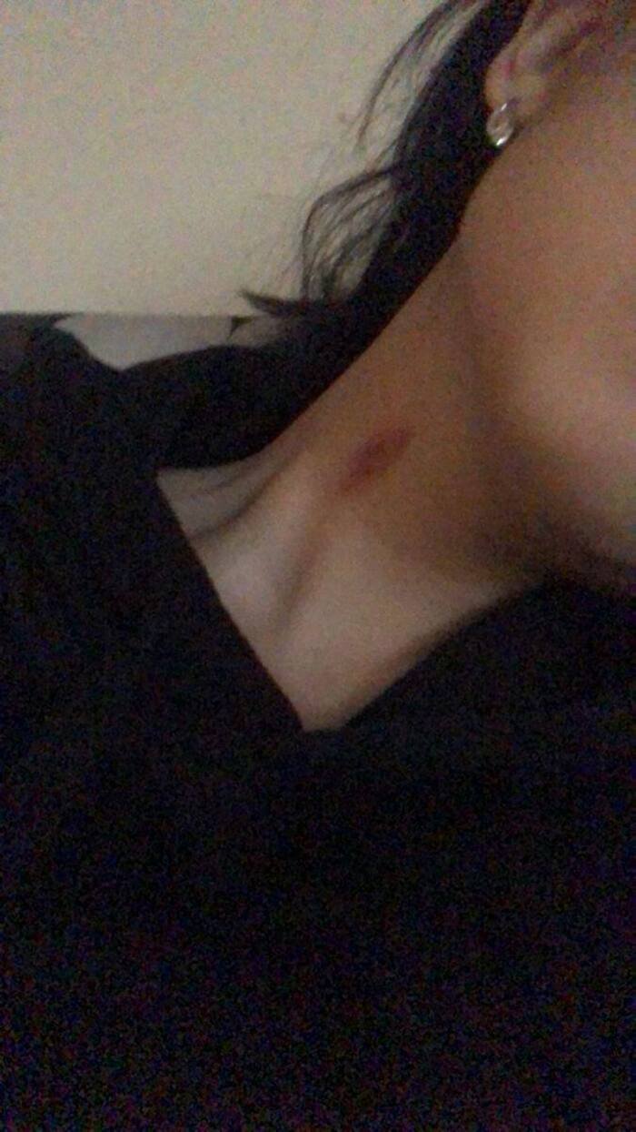 love bites images pinterest