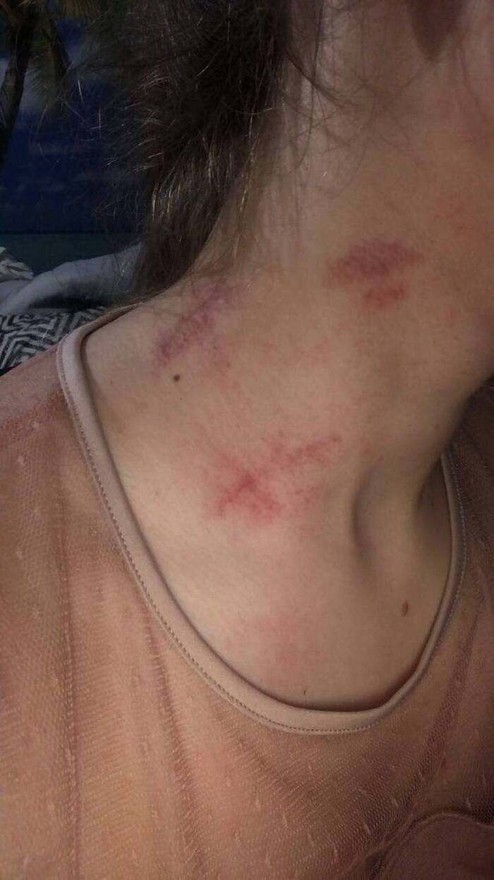 photo love bites images